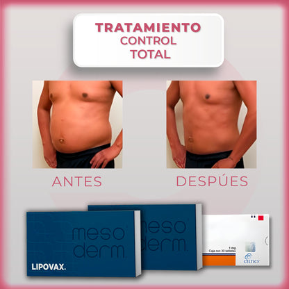 Tratamiento Control Total