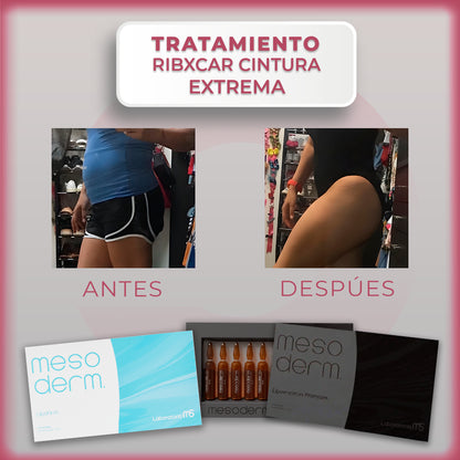 Tratamiento Ribxcar cintura extrema