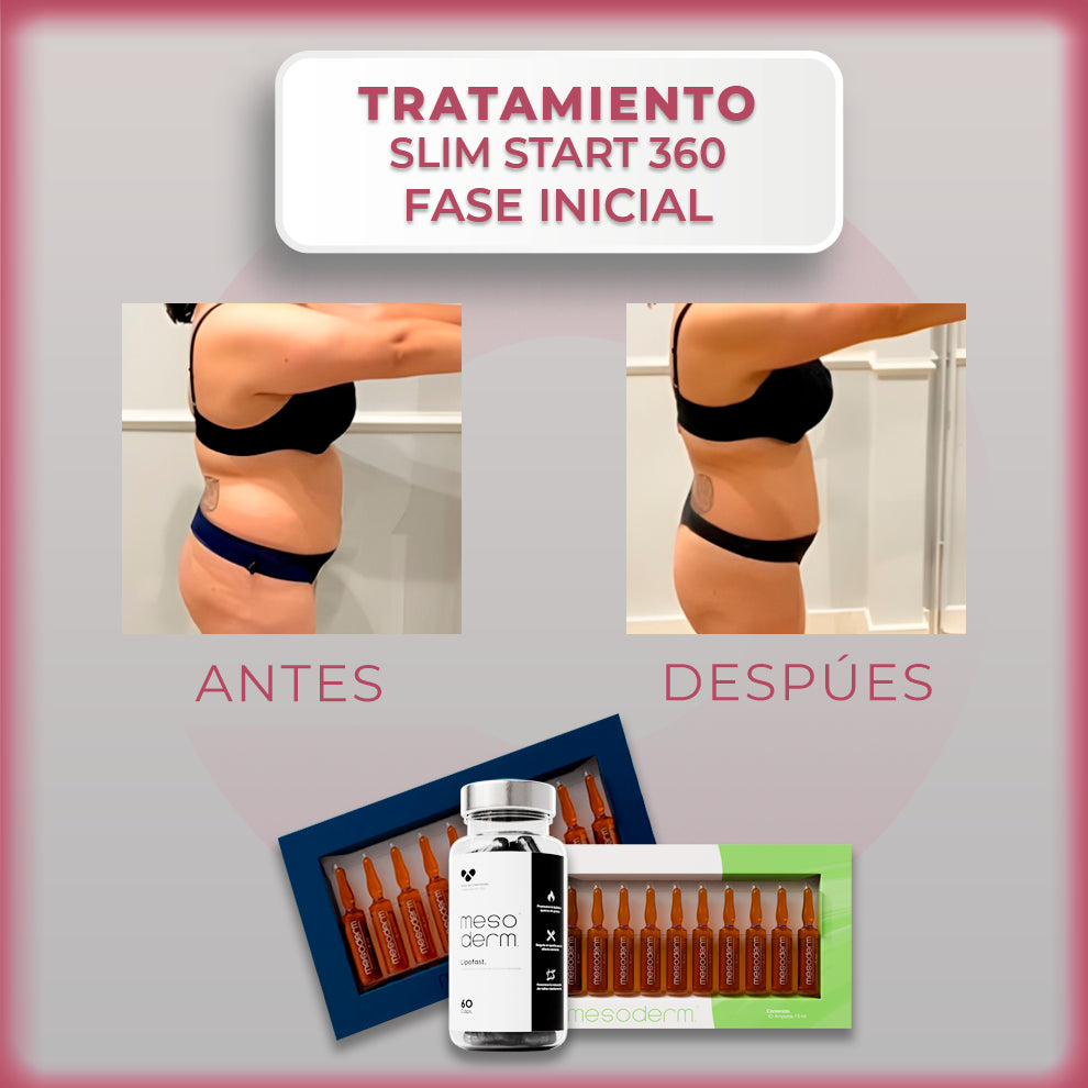 SLIM START 360 – FASE INICIAL