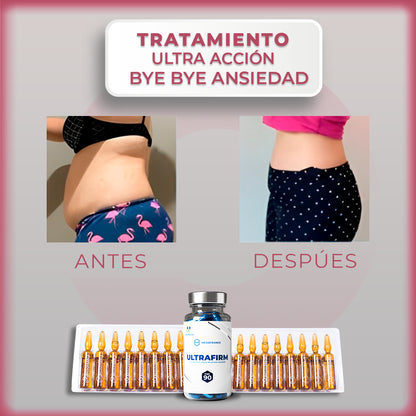 Tratamiento Ultra Acción: Bye Bye Ansiedad