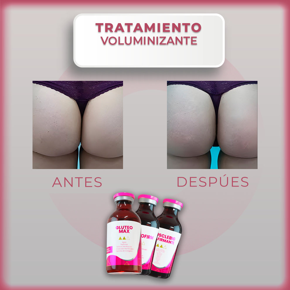 Tratamiento Voluminizante