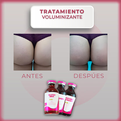 Tratamiento Voluminizante